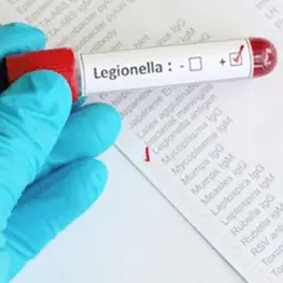 Legionella Vinext TwinOxide
